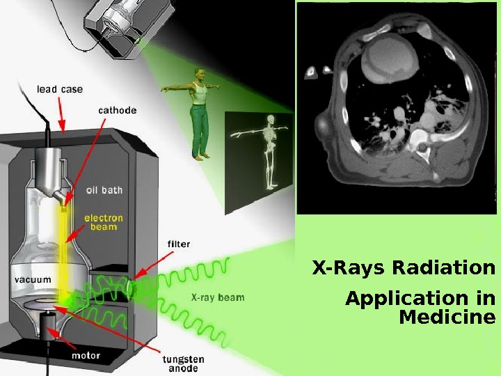 X-Rays Radiation Application In Medicine IONIZING RADIATION