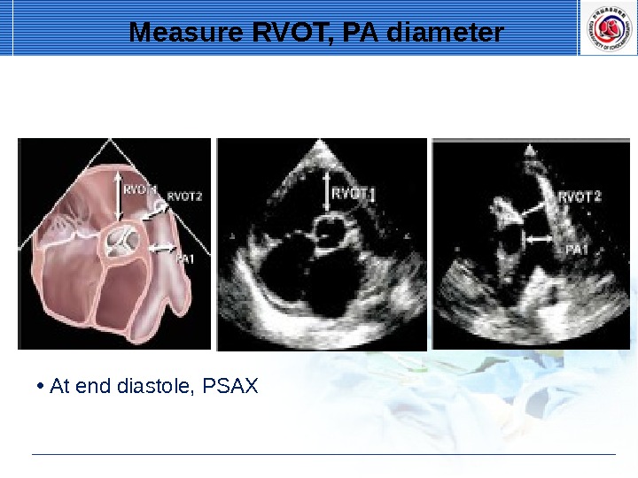 Transthoracic Echocardiography. Standard Imaging Of A.