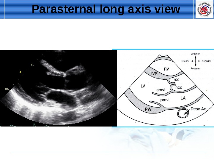 Transthoracic Echocardiography. Standard Imaging Of A.