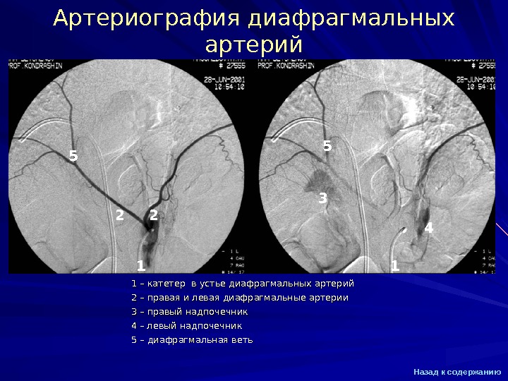 Презентация Ангиография