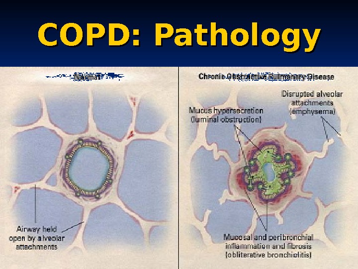 pulmonary-conditions-dr-flores-pulmonology