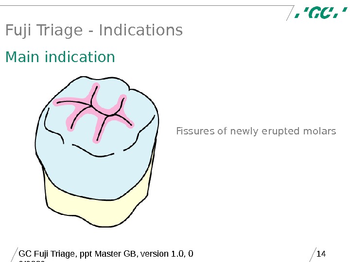 Fuji Triage from GC. Simple