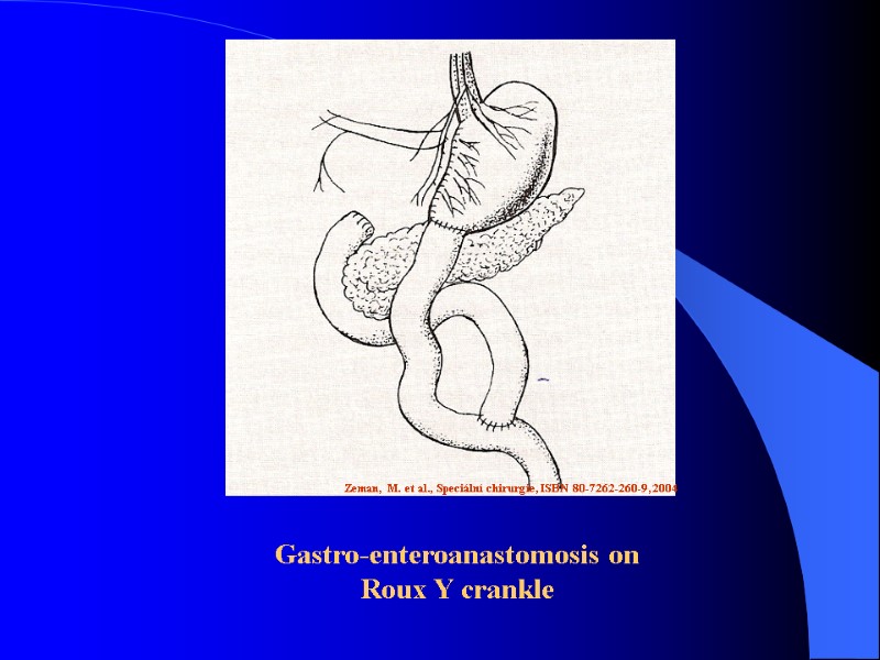 Gastric And Duodenal Ulcer Disease Anatomy Arterial Blood