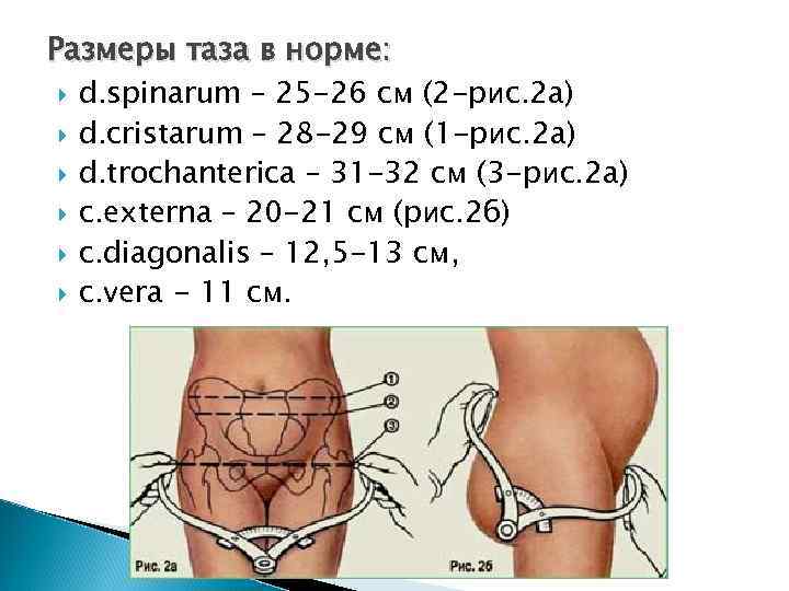 Причины Варикоза Таза