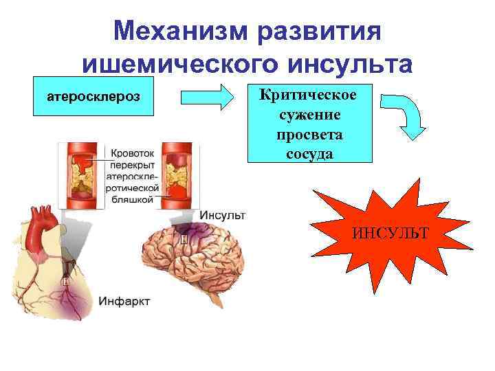 Диета При Церебральном Атеросклерозе Головного Мозга