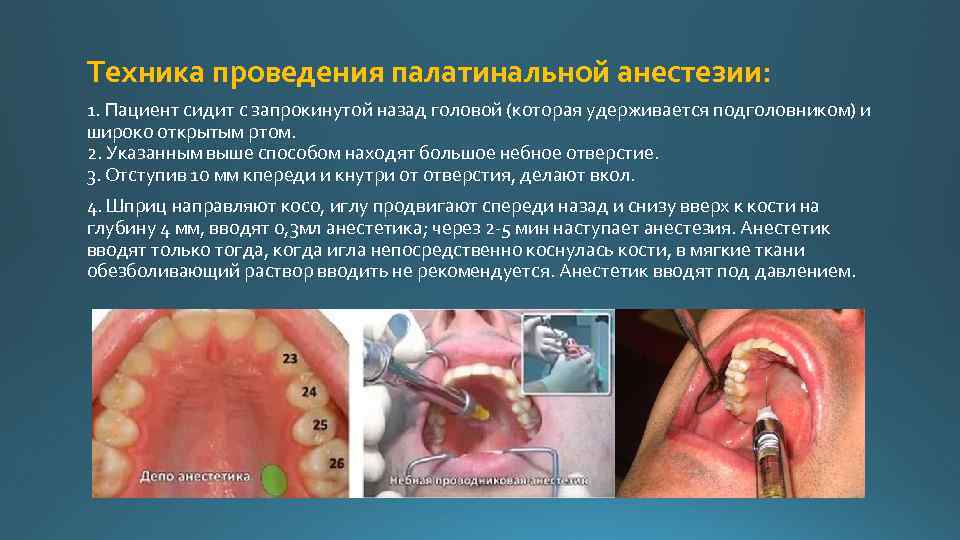 Местная анестезия в стоматологии Местная анестезия anaesthesia