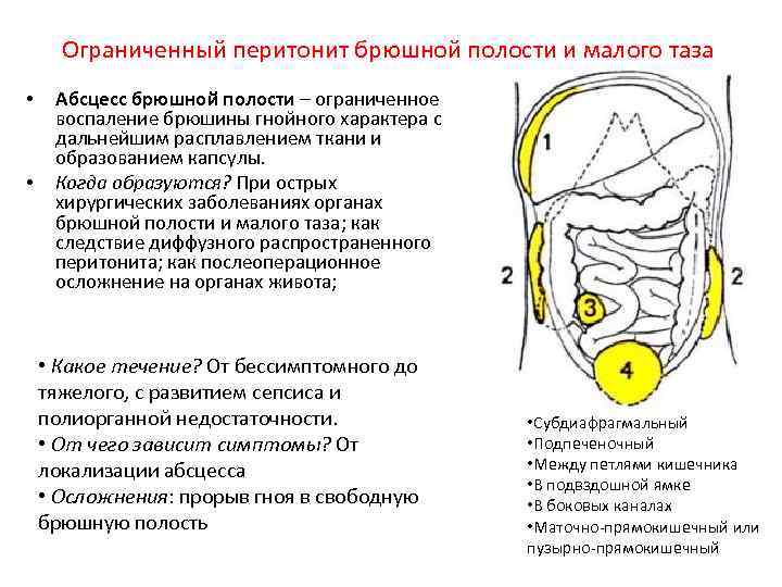 Варикоз Брюшной Полости Причины