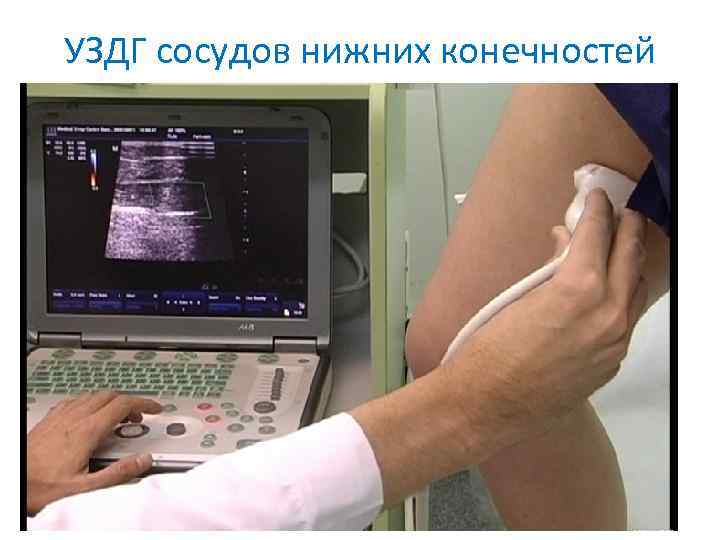 Диета При Дуплексном Сканировании Вен Нижних Конечностей