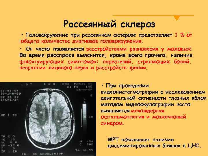 Диета Эмбри При Рассеянном Склерозе