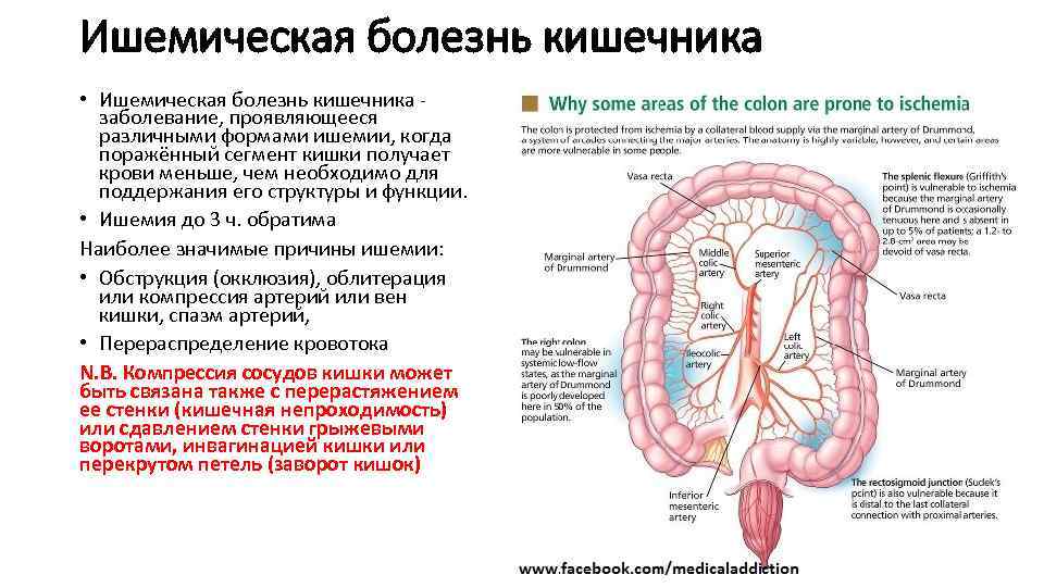 Расширение Вен Кишечника