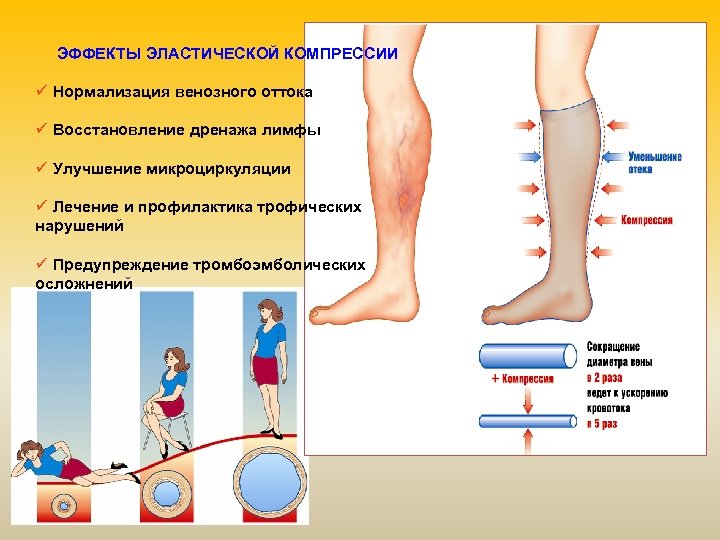 Варикозные Трофические Язвы На Ногах