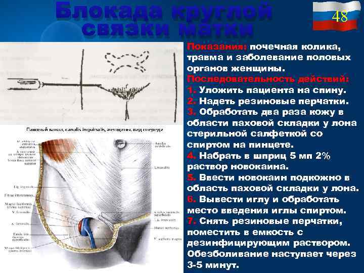 Варикоз Женских Органов Разрыв Узлов