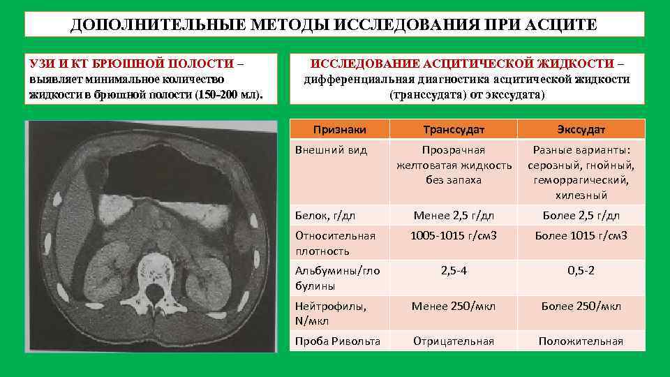 Варикоз Брюшной Полости Цена