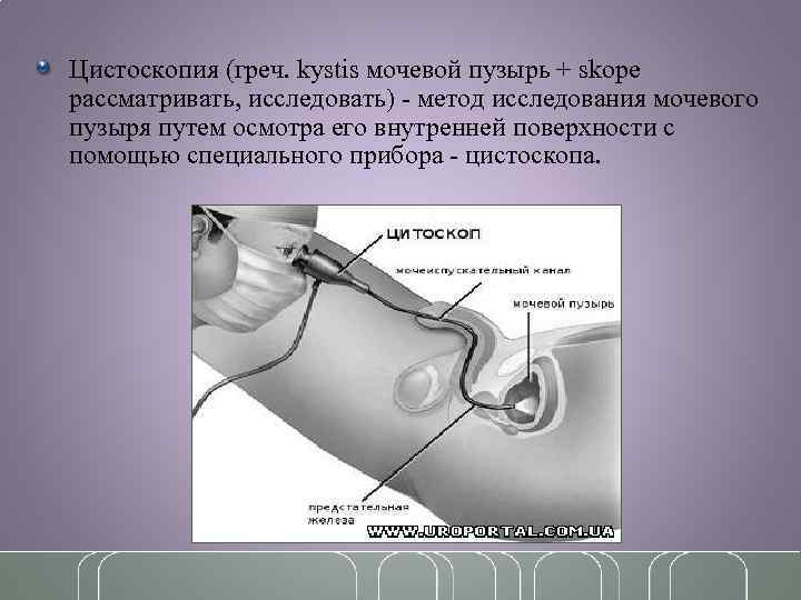 Можно Ли Заниматься Сексом После Цистоскопии