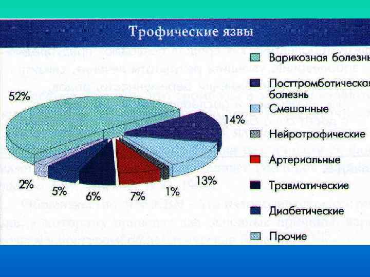 Варикозное Расширение Вен Статистика