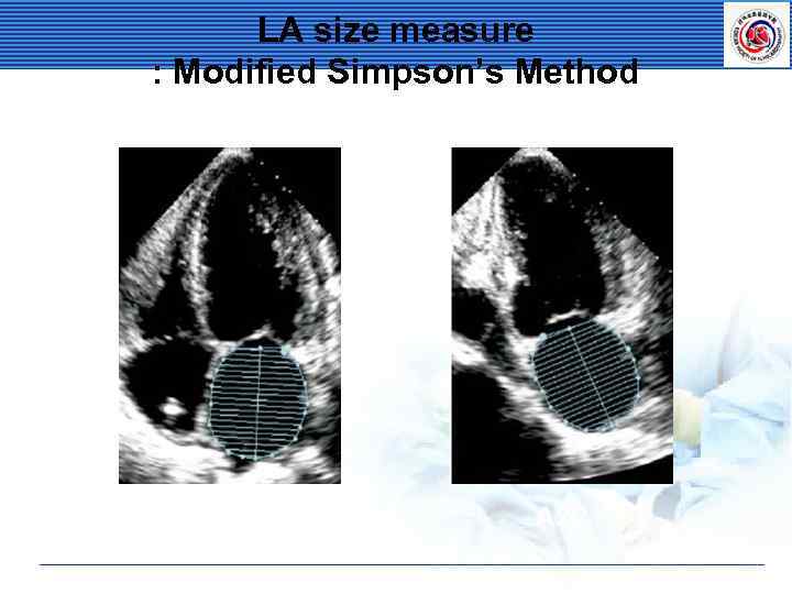 Standard Imaging Of Transthoracic Echocardiography Terminology A