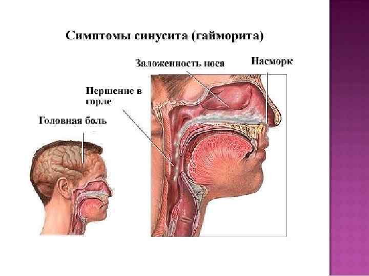 Диета При Полипах В Носу У Взрослых