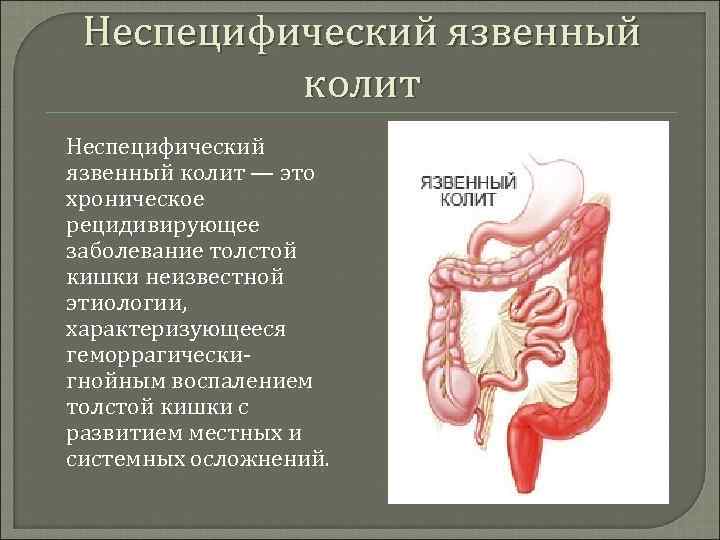 Во Время Секса Колит