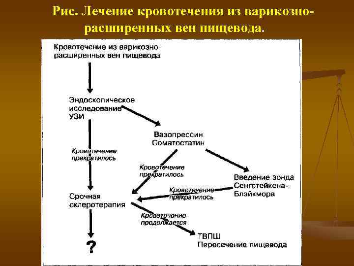 Варикозное Расширение Вен Этиология И Патогенез