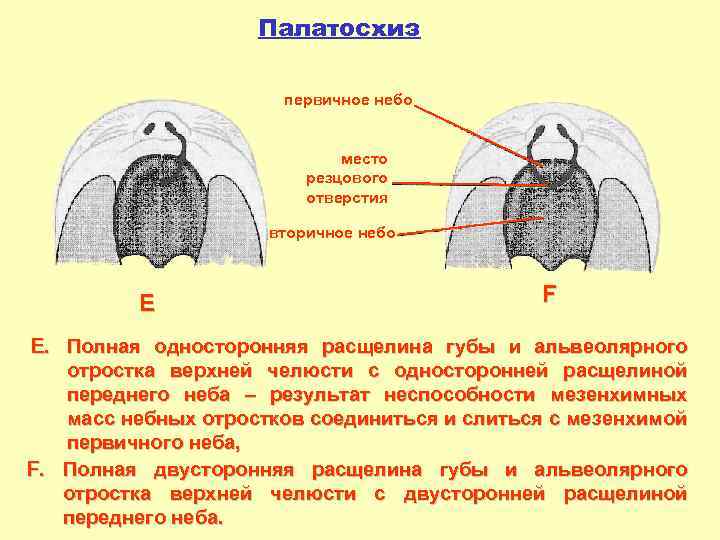 Большой аргумент шоколадного зайца проникает в узкую расщелину нимфы