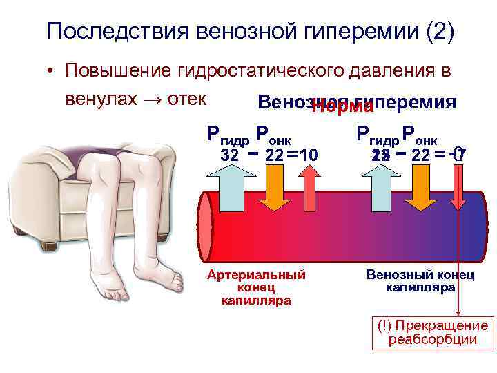 Варикозное Давление