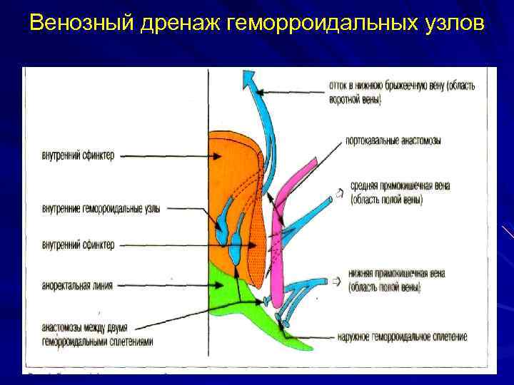 Узлы В Варикозных Венах