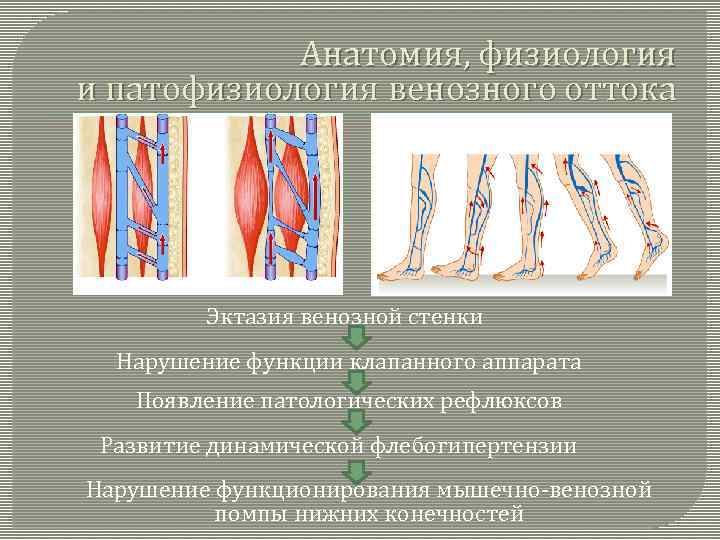 Варикозное Расширение Вен Этиология Патогенез