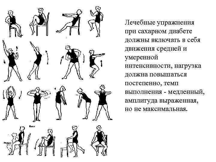 Варикоз Физические Упражнения Правильность Выполнения