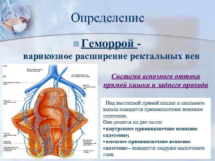 Варикоз Вен Заднего Прохода