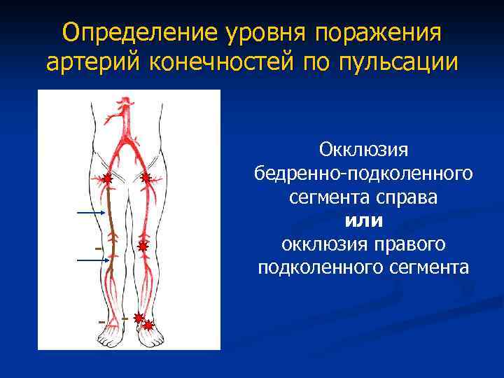 Варикоз Бедренной Артерии