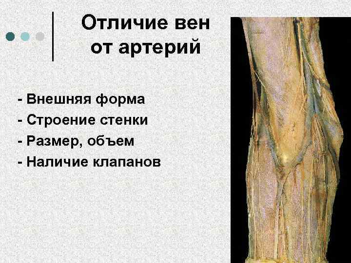 Вены Характеризуются