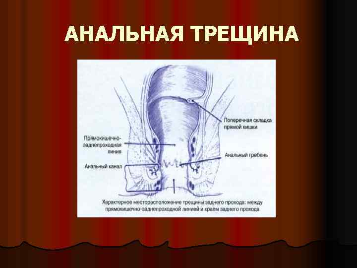 Трещины После Анального Секса