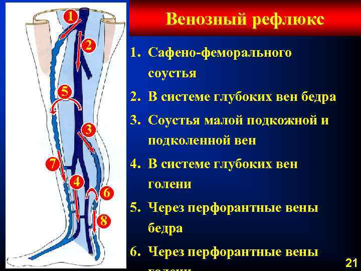 Варикоз 3 Степени Лечение