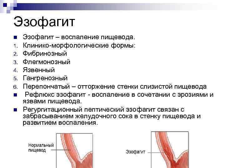 Варикозное Расширение Желудка