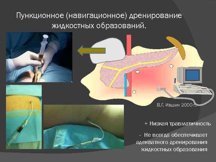 Можно Заниматься Сексом После Биопсии Простаты