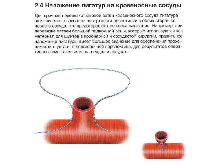 Перевязала Яйца И Дрочит