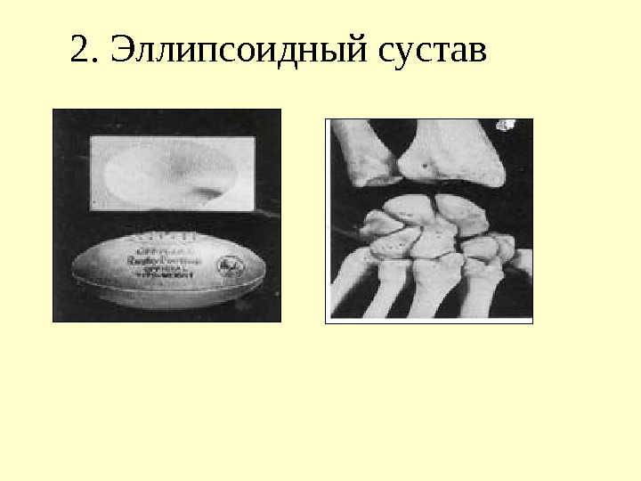 2. Эллипсоидный сустав 