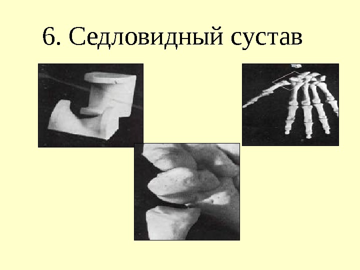 6. Седловидный сустав 