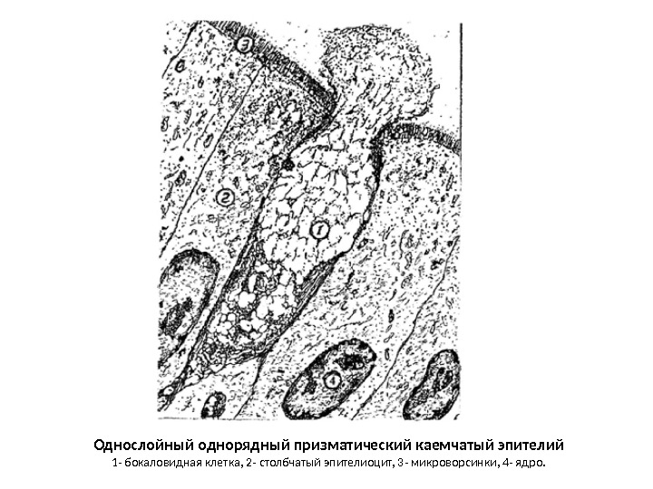 Однослойный однорядный призматический каемчатый эпителий 1 - бокаловидная клетка, 2 - столбчатый эпителиоцит, 3