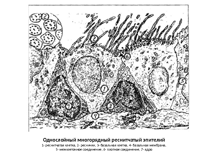 Однослойный многорядный реснитчатый эпителий 1 - реснитчатая клетка, 2 - реснички, 3 - базальная