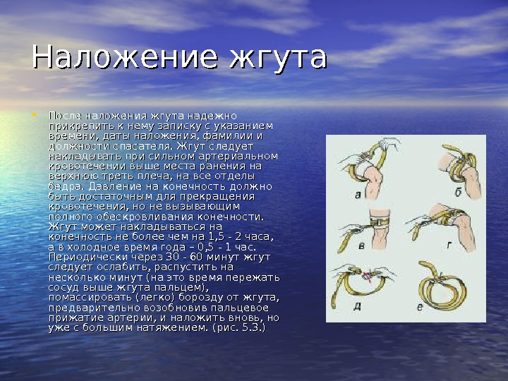 Наложение жгута • После наложения жгута надежно прикрепить к нему записку с указанием времени,