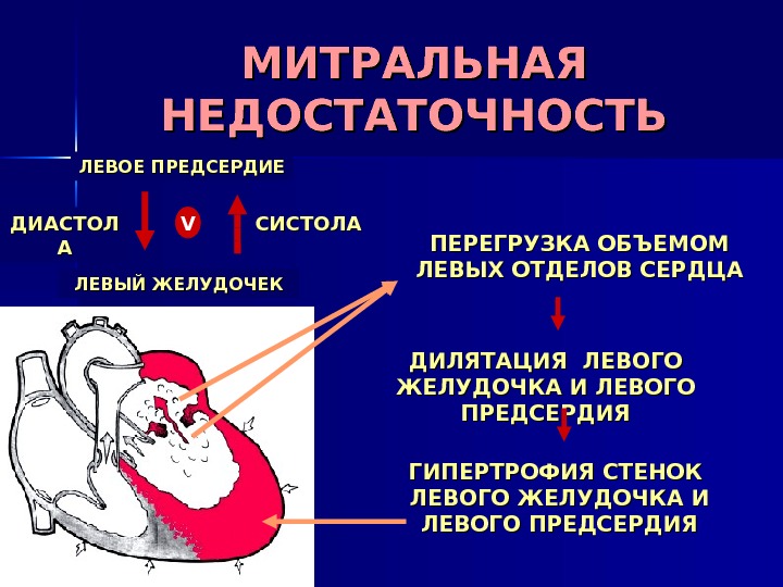 МИТРАЛЬНАЯ НЕДОСТАТОЧНОСТЬ ПЕРЕГРУЗКА ОБЪЕМОМ ЛЕВЫХ ОТДЕЛОВ СЕРДЦА ГИПЕРТРОФИЯ СТЕНОК  ЛЕВОГО ЖЕЛУДОЧКА И ЛЕВОГО