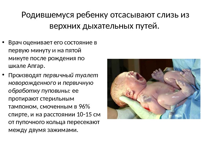 Родившемуся ребенку отсасывают слизь из верхних дыхательных путей.  • Врач оценивает его состояние