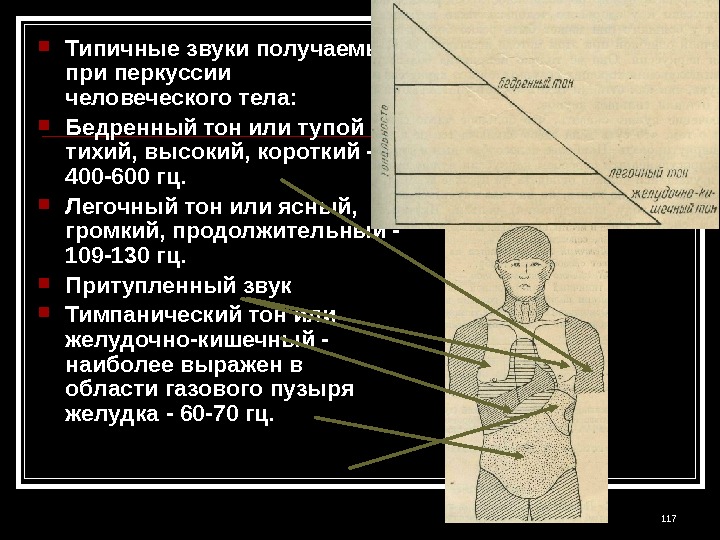  Типичные звуки получаемые при перкуссии человеческого тела:  Бедренный тон или тупой -