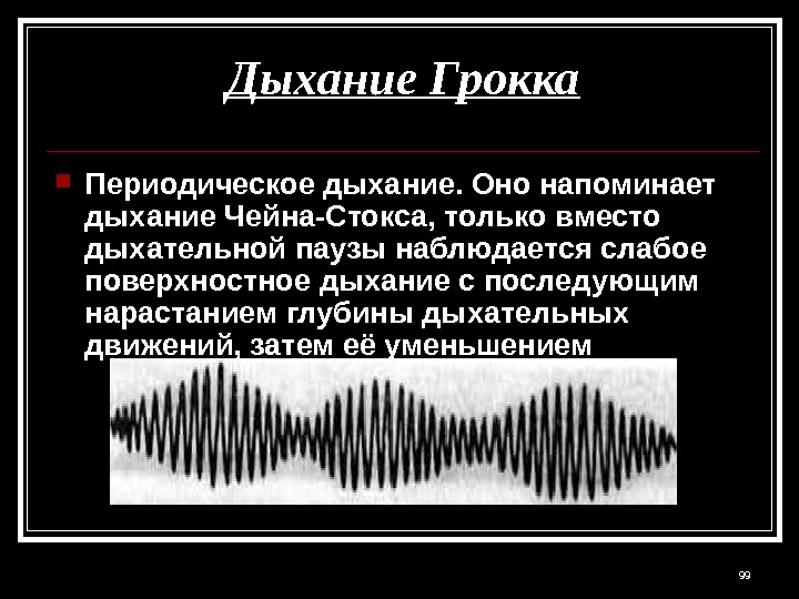 Дыхание Грокка Периодическое дыхание. Оно напоминает дыхание Чейна-Стокса, только вместо дыхательной паузы наблюдается слабое