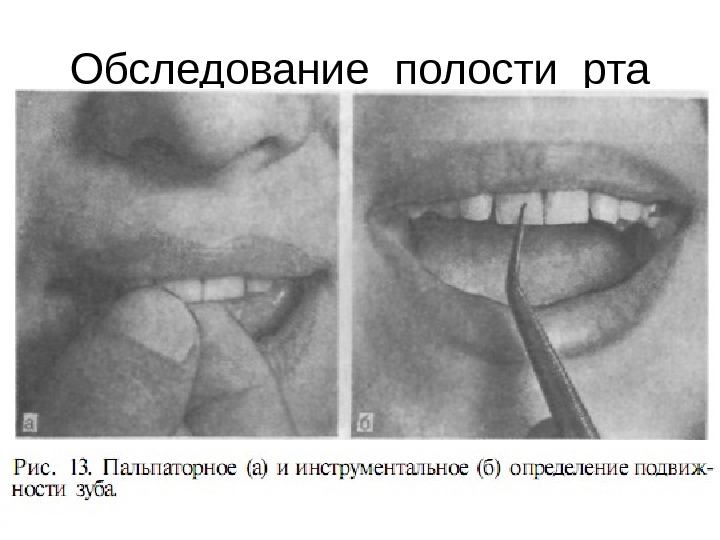 Обследование полости рта 
