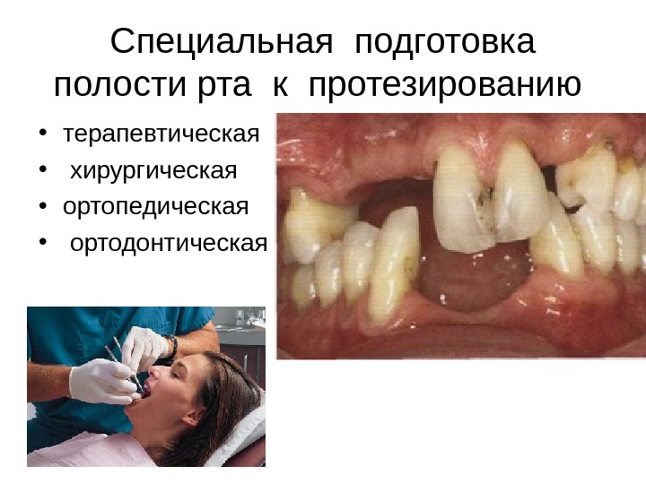 Специальная подготовка полости рта к протезированию  • терапевтическая •  хирургическая • ортопедическая