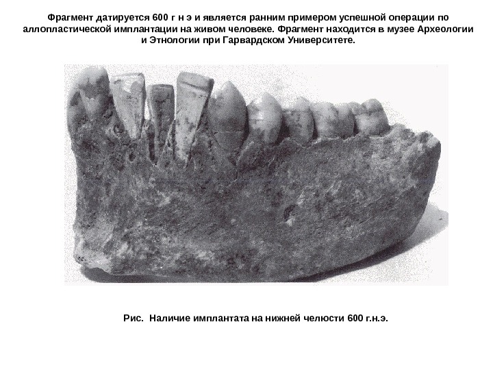 Фрагмент датируется 600 г н э и является ранним примером успешной операции по аллопластической
