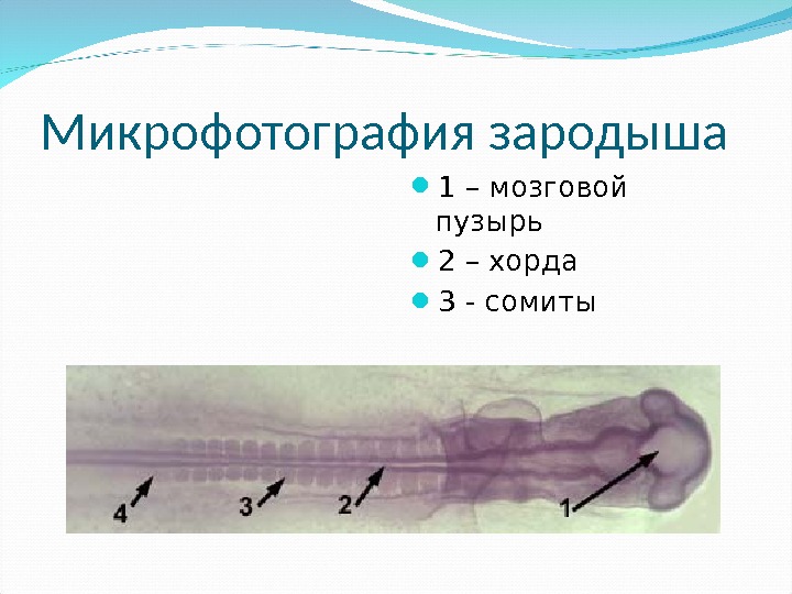 Микрофотография зародыша 1 – мозговой пузырь 2 – хорда 3 - сомиты 