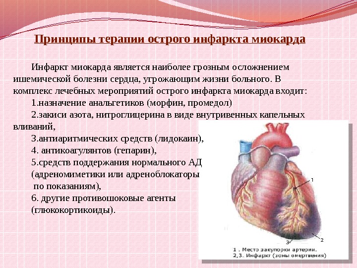 Принципы терапии острого инфаркта миокарда Инфаркт миокарда является наиболее грозным осложнением ишемической болезни сердца,